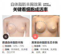 昭通做自體脂肪豐胸，怎么提高脂肪存活率