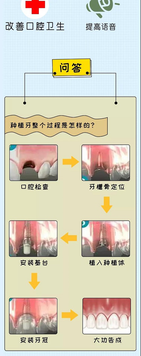 牙齒矯正可以用一輩子嗎？