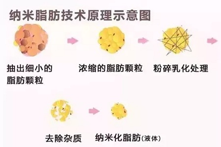 拿什么拯救你，我的黑眼圈？