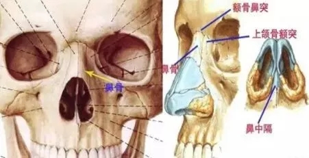 側面看鼻梁不矮,正面看鼻子卻很塌是什么原因？