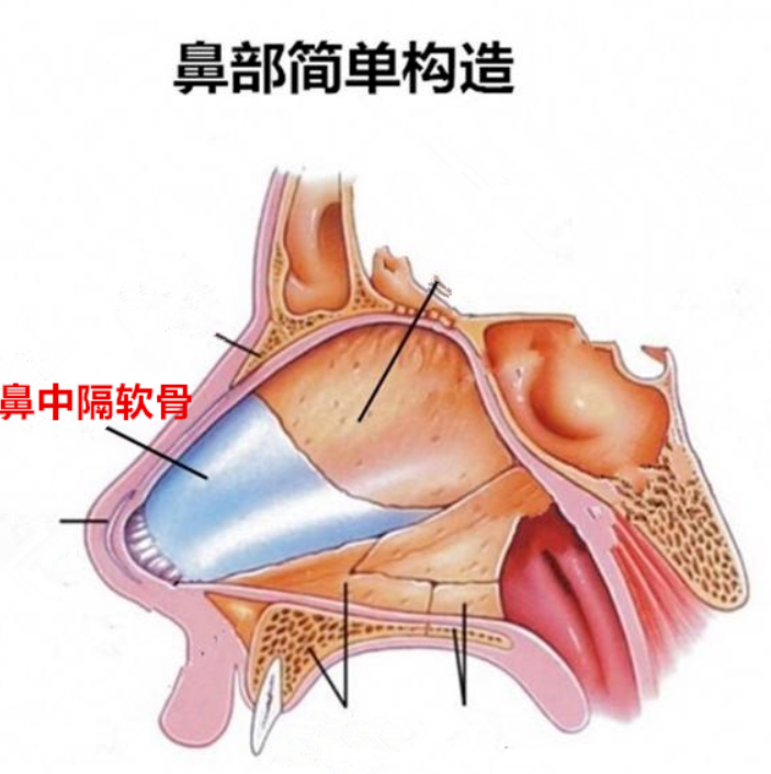 隆鼻